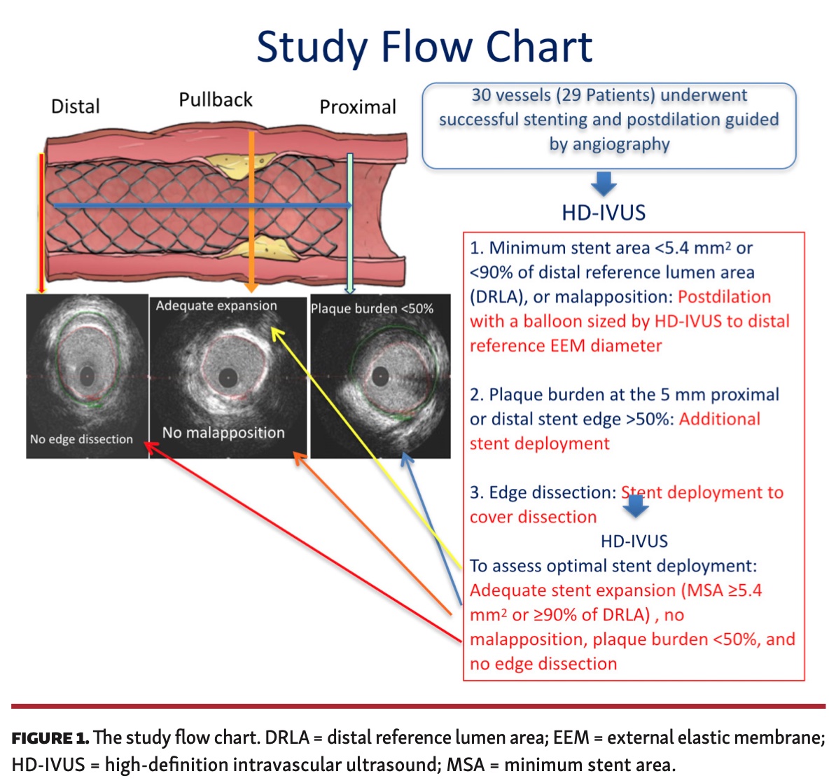 A New Method to Optimize Stent Deployment by HighDefinition